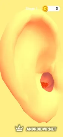 Earwax Clinic фото 2